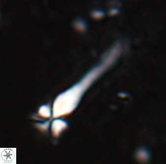 Sphenolithus heteromorphus 27688