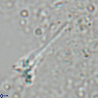 Sphenolithus heteromorphus 27689