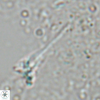 Sphenolithus heteromorphus 27689