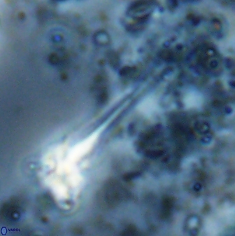 Sphenolithus heteromorphus 27690