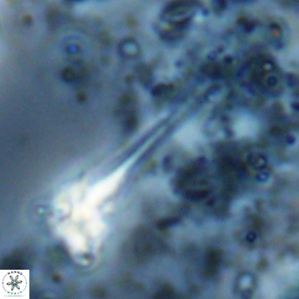 Sphenolithus heteromorphus 27690