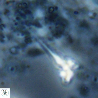 Sphenolithus heteromorphus 27691