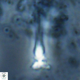 Sphenolithus heteromorphus 27692