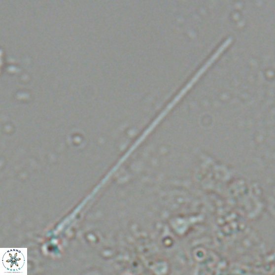 Sphenolithus heteromorphus 27761