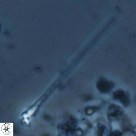Sphenolithus heteromorphus 27762
