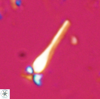 Sphenolithus heteromorphus 27700
