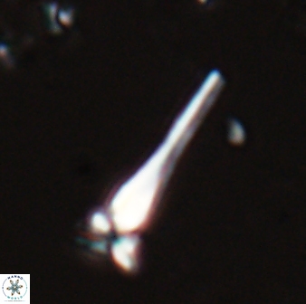 Sphenolithus heteromorphus 27701