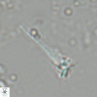 Sphenolithus heteromorphus 27702