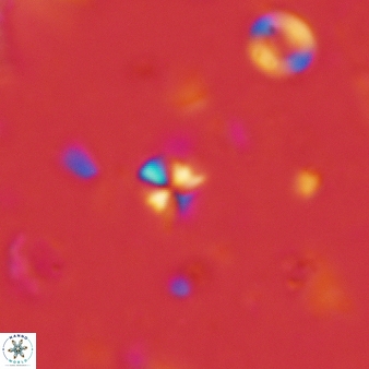 Sphenolithus humilis 268