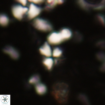 Sphenolithus humilis 300