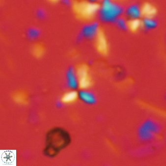 Sphenolithus humilis 302