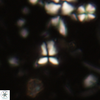 Sphenolithus humilis 303