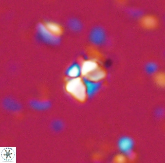Sphenolithus orthogonio 42879