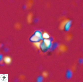 Sphenolithus orthogonio 42881