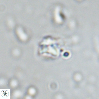 Sphenolithus orthogonio 42883