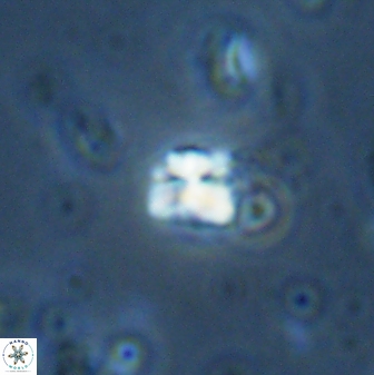 Sphenolithus orthogonio 42884