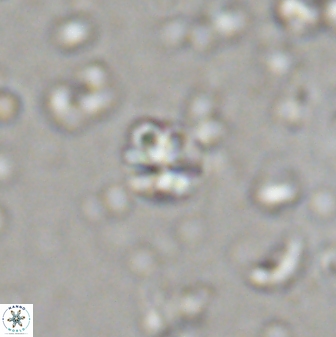Sphenolithus orthogonio 43115
