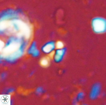 Sphenolithus orthogonio 43496