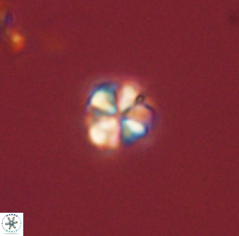 Sphenolithus orthogonio 44498