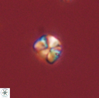 Sphenolithus orthogonio 44501