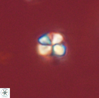 Sphenolithus orthogonio 44502