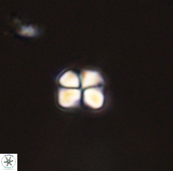 Sphenolithus orthogonio 44506