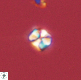 Sphenolithus orthogonio 44512