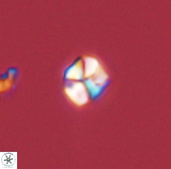 Sphenolithus orthogonio 44513