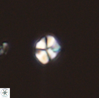 Sphenolithus orthogonio 44514