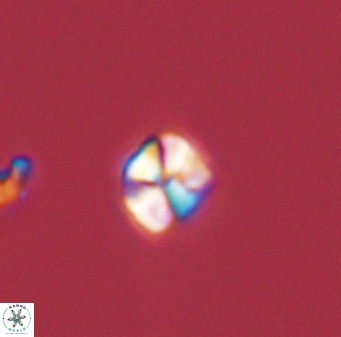 Sphenolithus orthogonio 44516