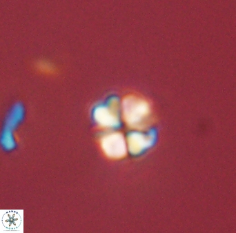 Sphenolithus orthogonio 44520