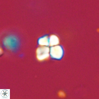 Sphenolithus orthogonio 67647