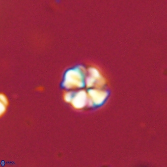 Sphenolithus orthogonio 67650