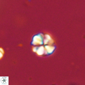 Sphenolithus orthogonio 67650