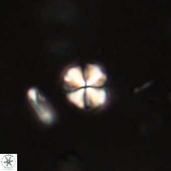 Sphenolithus orthogonio 67652