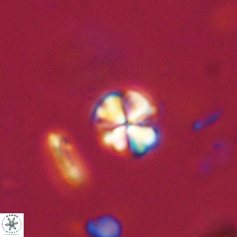Sphenolithus orthogonio 67653