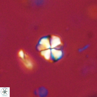 Sphenolithus orthogonio 67658