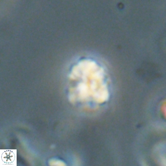 Sphenolithus orthogonio 67661