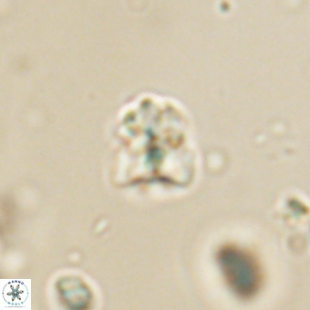 Sphenolithus orthogonio 67663