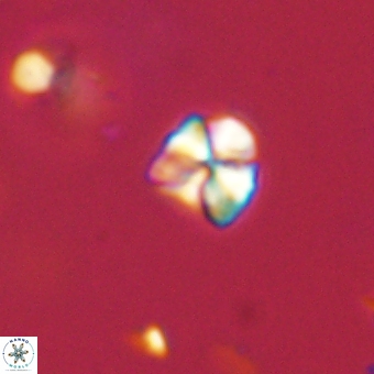 Sphenolithus orthogonio 67639
