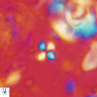 Sphenolithus moriformis 100
