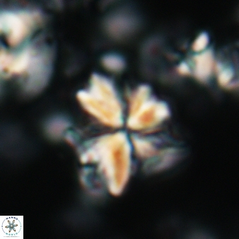 Sphenolithus moriformis 175
