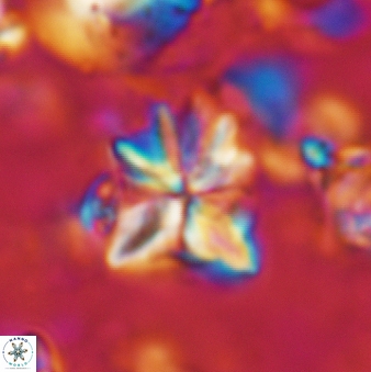 Sphenolithus moriformis 177