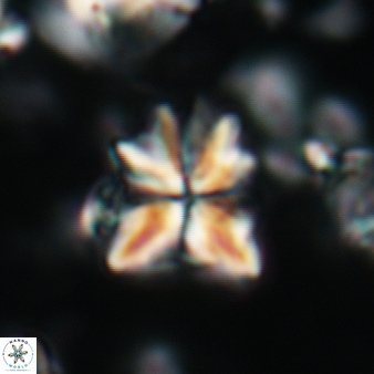 Sphenolithus moriformis 178