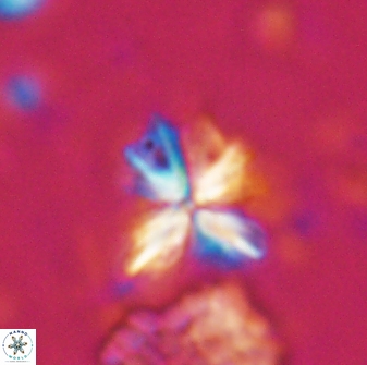 Sphenolithus moriformis 27159