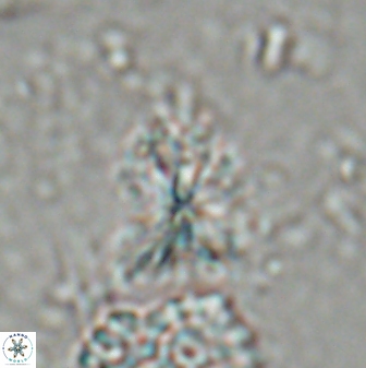 Sphenolithus moriformis 27166
