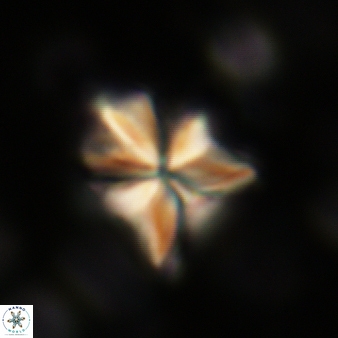 Sphenolithus moriformis 285