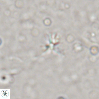 Sphenolithus moriformis 29898