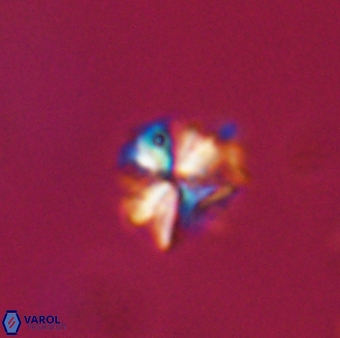 Sphenolithus moriformis 30215