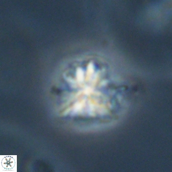 Sphenolithus moriformis 30223
